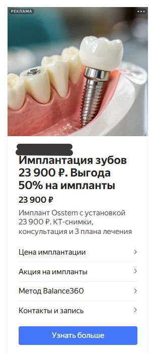 Реклама стоматологии в РСЯ: имплантация зубов 23 900 рублей, выгода 50% на импланты